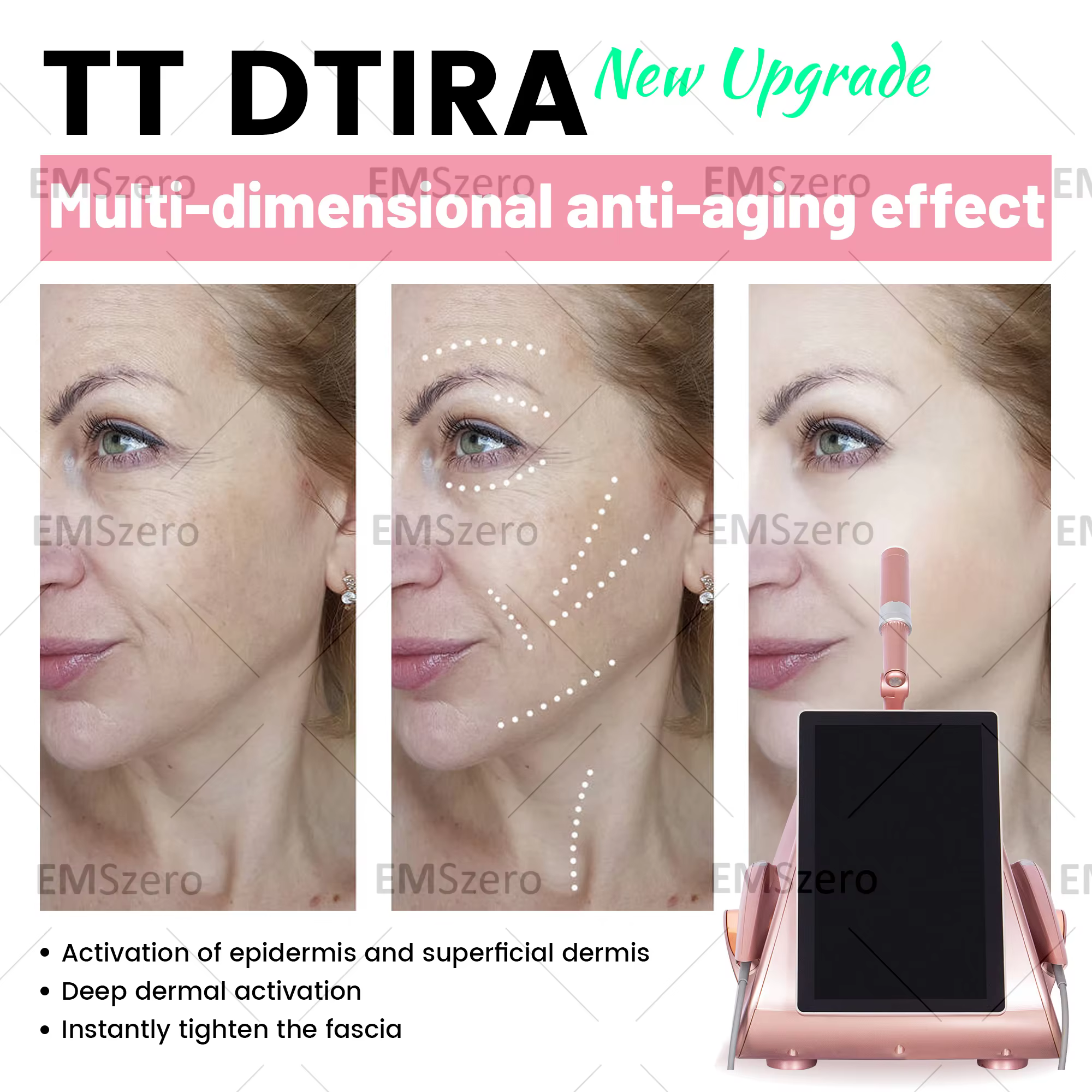 Professional RF Skin Tightening Device for Face 12D Body At Home Beauty Machine with Anti Aging Facial Lifting  Non  Skin.